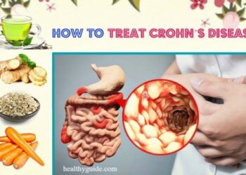 Natural Remedies to Treat Crohn's and Colitis [Slideshow]
